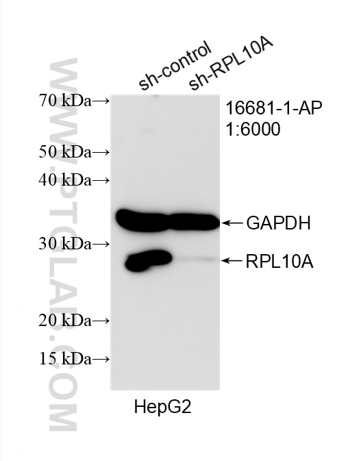 WB analysis of HepG2 using 16681-1-AP Western Blot (WB) analysis of HepG2 cells using RPL10A Polyclonal antibody (16681-1-AP)