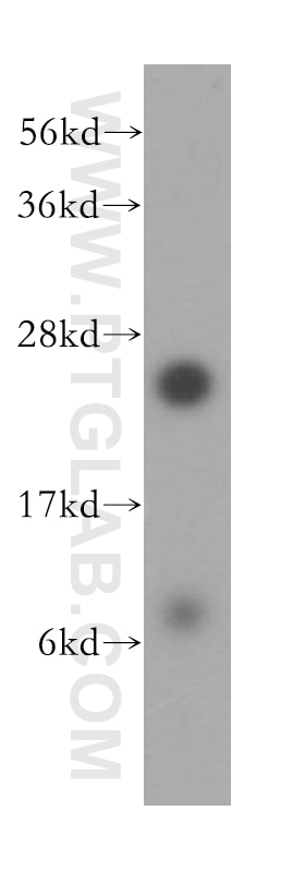 Western Blot (WB) analysis of HeLa cells using RPL10A Polyclonal antibody (16681-1-AP)