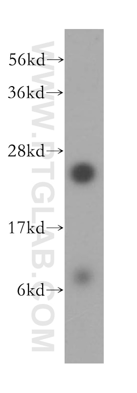 WB analysis of HeLa using 16681-1-AP