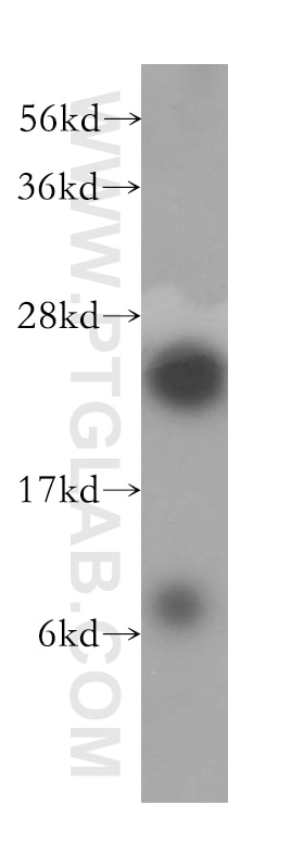 Western Blot (WB) analysis of HepG2 cells using RPL10A Polyclonal antibody (16681-1-AP)