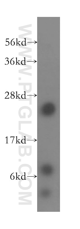 Western Blot (WB) analysis of human liver tissue using RPL10A Polyclonal antibody (16681-1-AP)