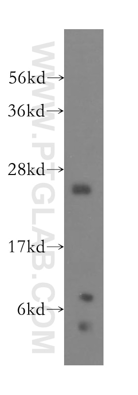 Western Blot (WB) analysis of human brain tissue using RPL10A Polyclonal antibody (16681-1-AP)