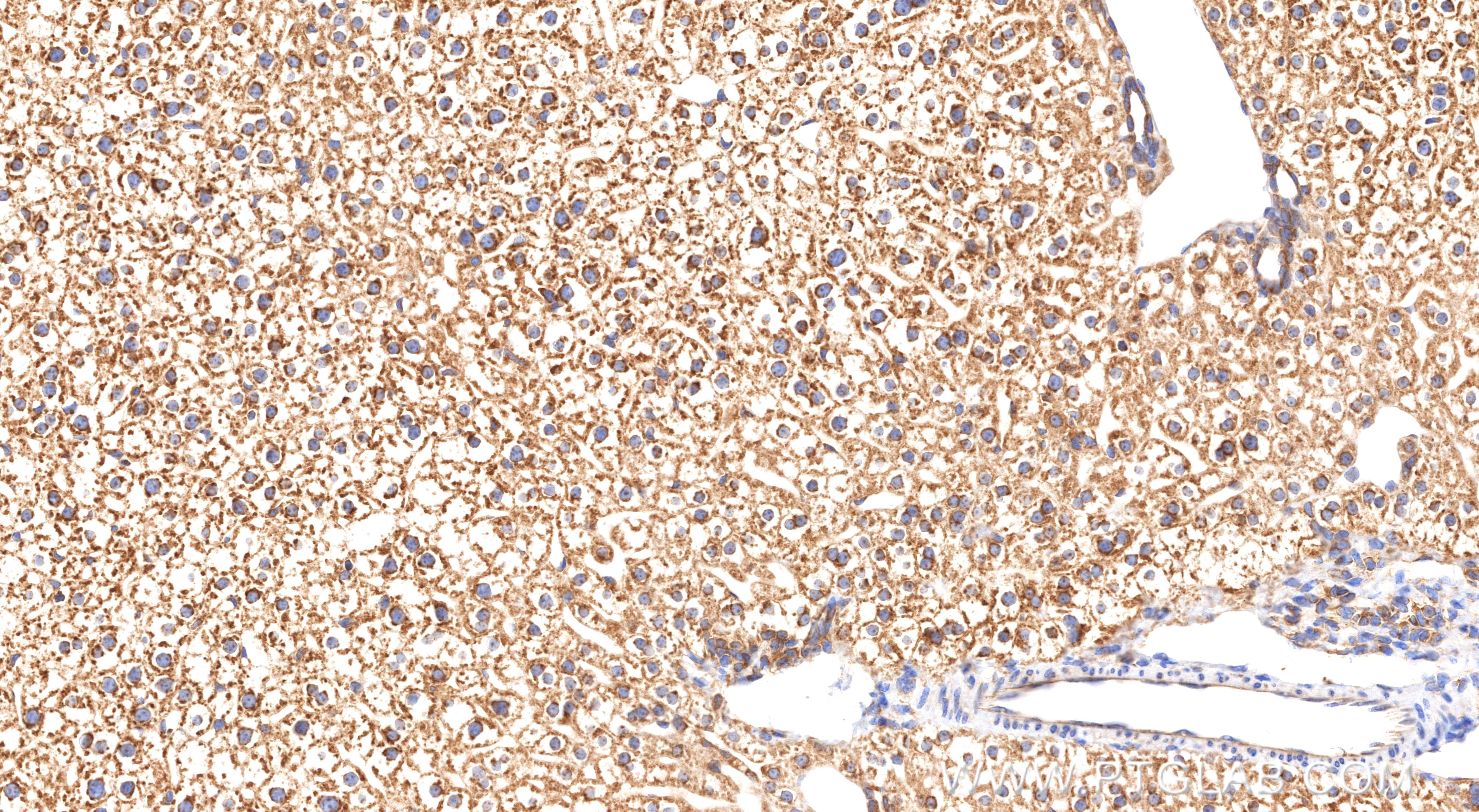 Immunohistochemical analysis of paraffin-embedded mouse liver tissue slide using 85685-1-RR (RPL10A antibody) at dilution of 1:1000 (under 20x lens). Heat mediated antigen retrieval with Tris-EDTA buffer (pH 9.0). Immunohistochemistry (IHC) staining of mouse liver tissue using RPL10A Recombinant monoclonal antibody (85685-1-RR)