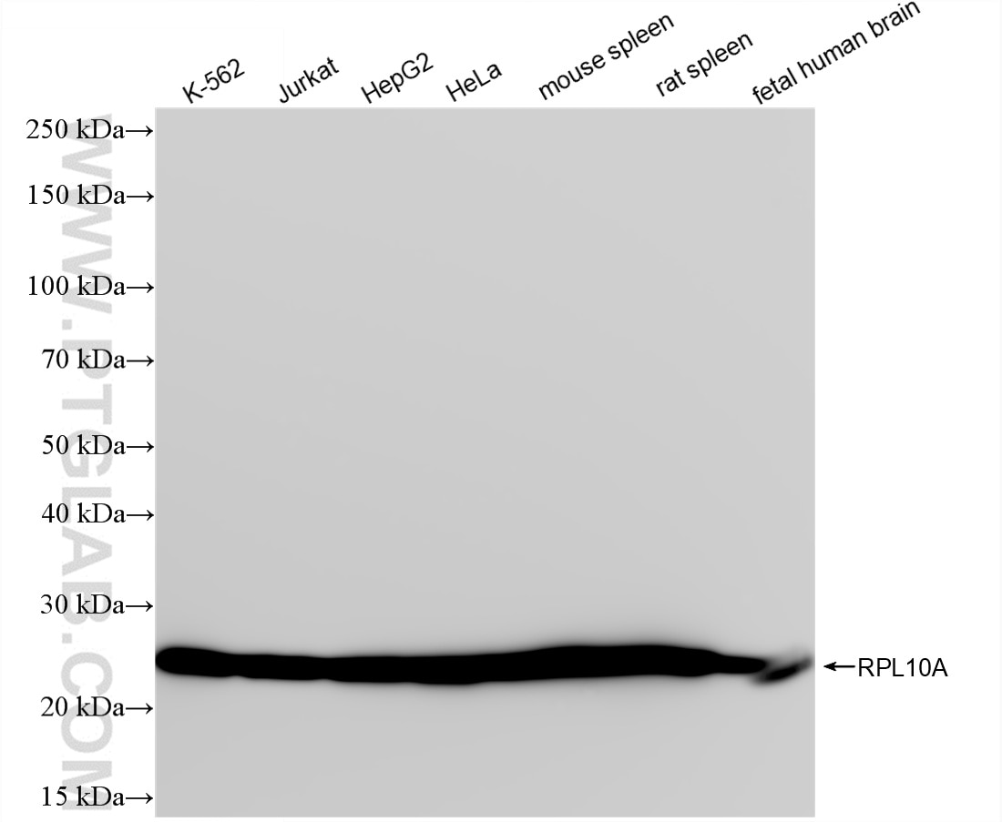 Western Blot (WB) analysis of various lysates using RPL10A Recombinant antibody (85685-1-RR)