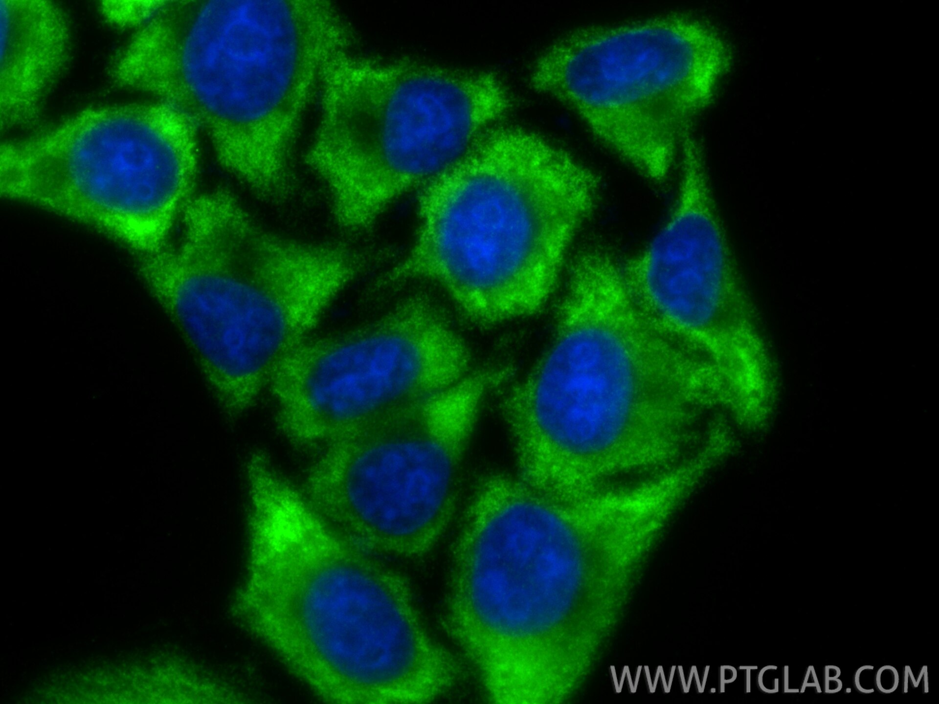 Immunofluorescence (IF) / fluorescent staining of HepG2 cells using Multi-rAb® RPL10A Multi-Recombinant antibody (RMX00046)