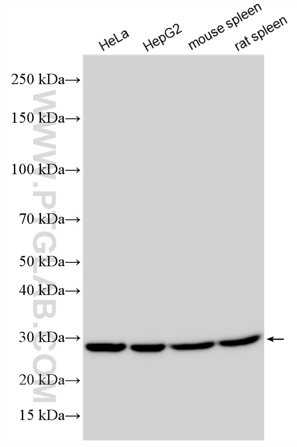 Western Blot (WB) analysis of various lysates using Multi-rAb® RPL10A Multi-Recombinant antibody (RMX00046)