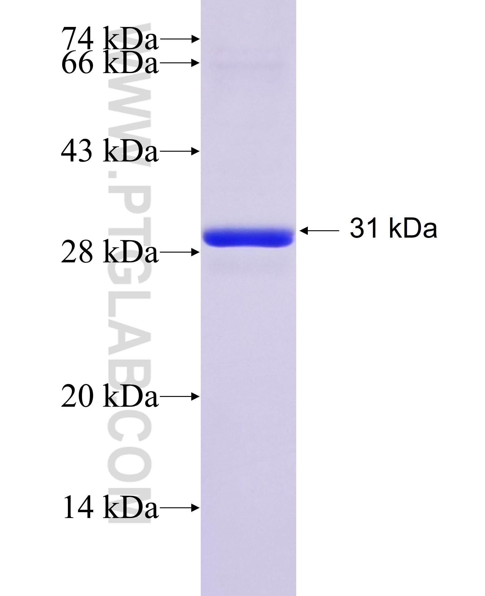 RPL10A fusion protein Ag30526 SDS-PAGE