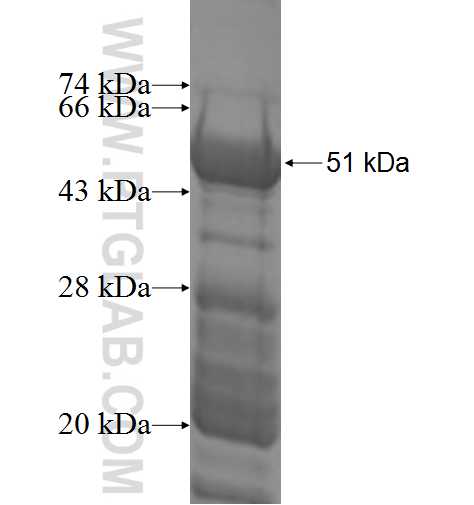 RPL10A fusion protein Ag10009 SDS-PAGE