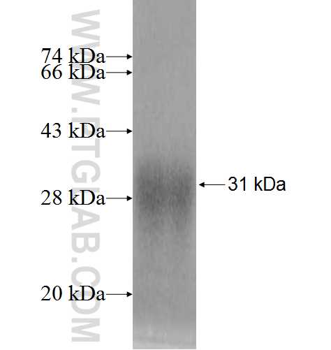 RPL10L fusion protein Ag9575 SDS-PAGE