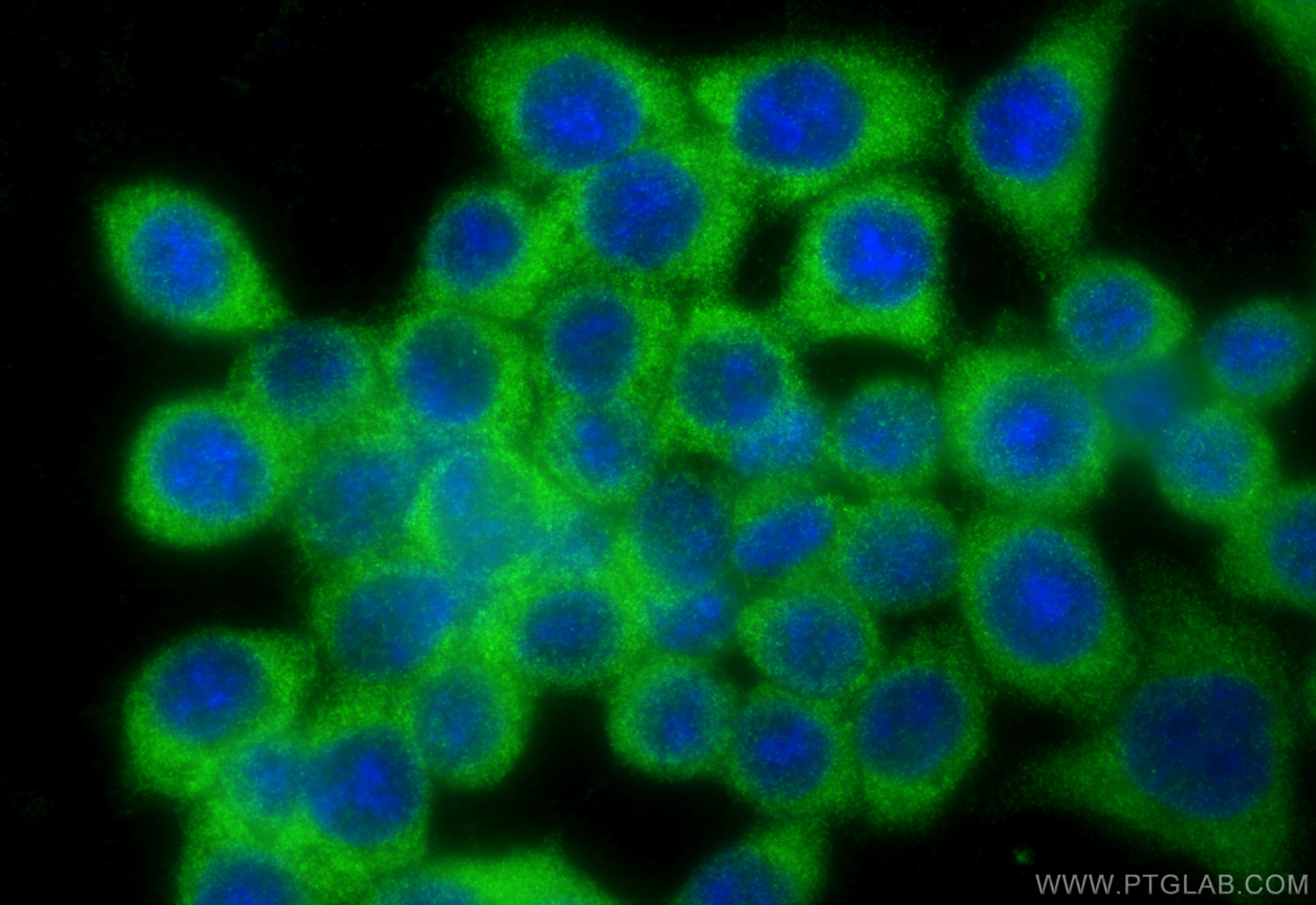 Immunofluorescence (IF) / fluorescent staining of BxPC-3 cells using RPL11 Polyclonal antibody (16277-1-AP)