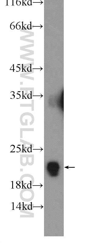 Western Blot (WB) analysis of rat liver tissue using RPL11 Polyclonal antibody (16277-1-AP)
