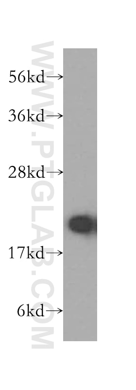 Western Blot (WB) analysis of human liver tissue using RPL11 Polyclonal antibody (16277-1-AP)