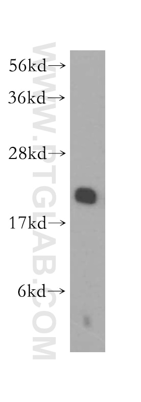 Western Blot (WB) analysis of mouse pancreas tissue using RPL11 Polyclonal antibody (16277-1-AP)