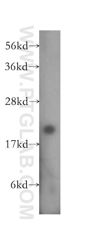 Western Blot (WB) analysis of BxPC-3 cells using RPL11 Polyclonal antibody (16277-1-AP)