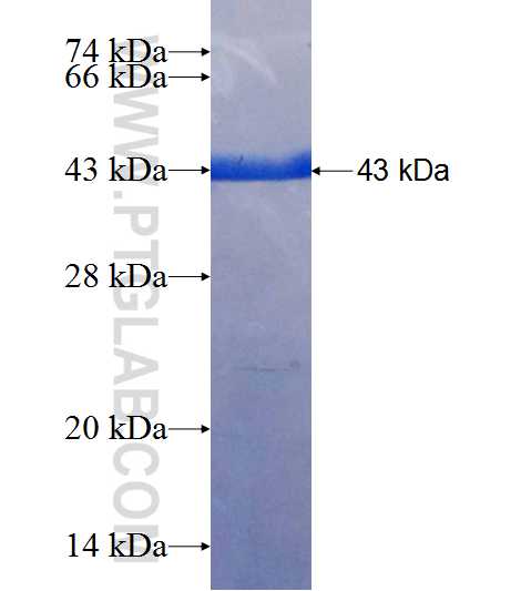 RPL11 fusion protein Ag9356 SDS-PAGE