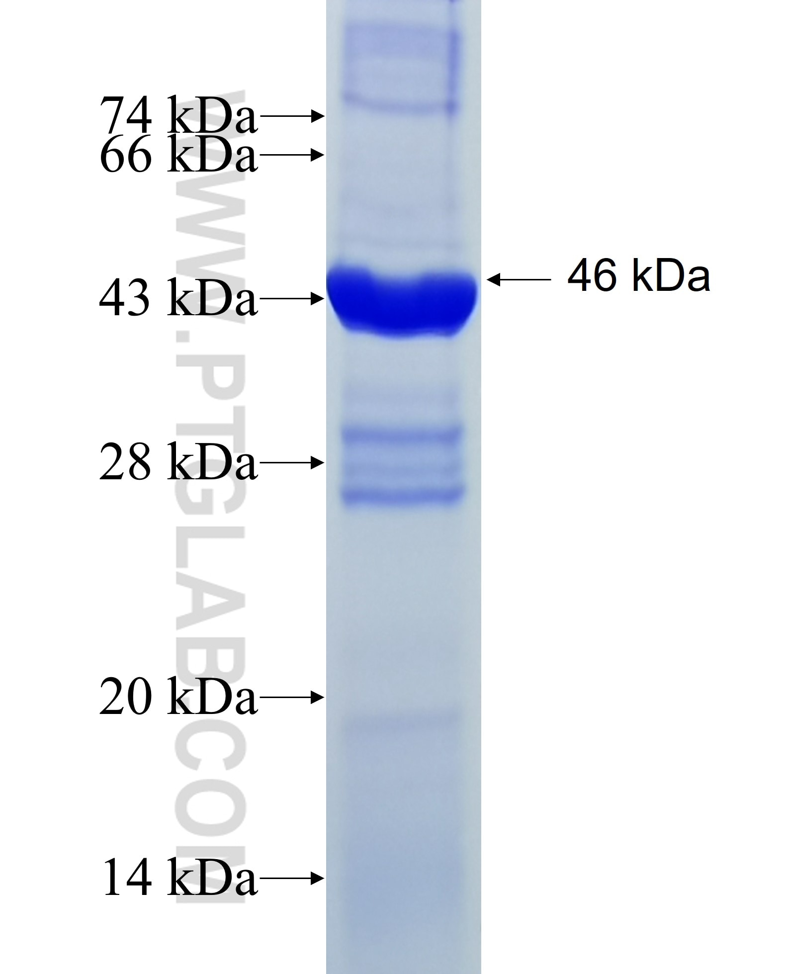 RPL11 fusion protein Ag9356 SDS-PAGE