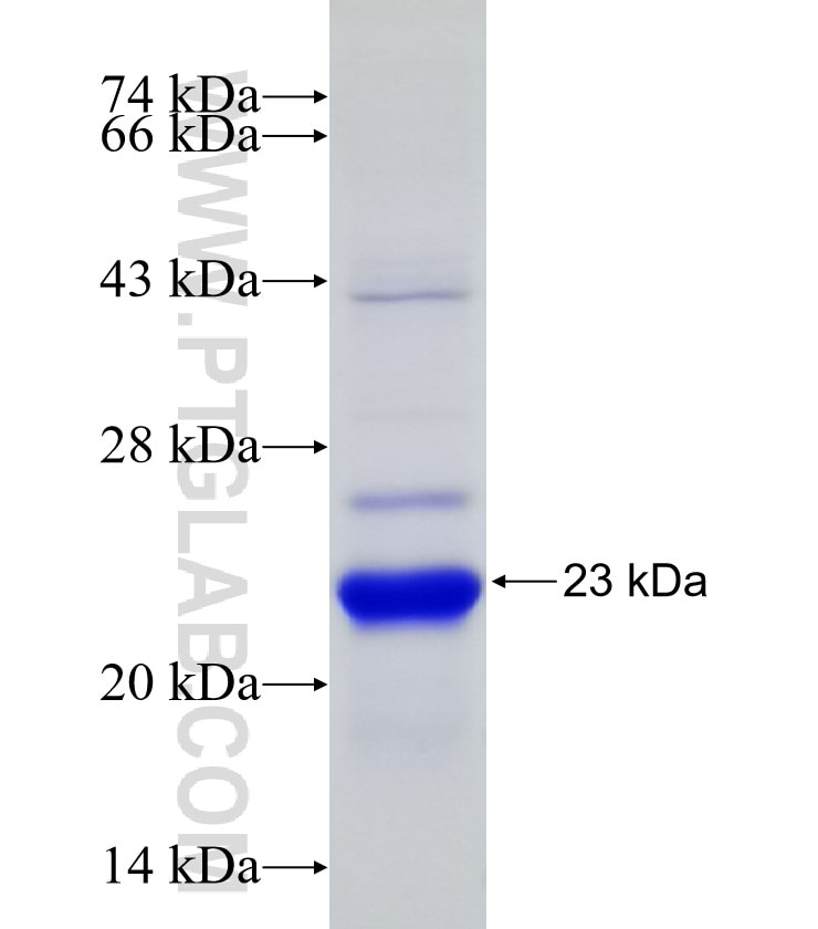 RPL11 fusion protein Ag9635 SDS-PAGE