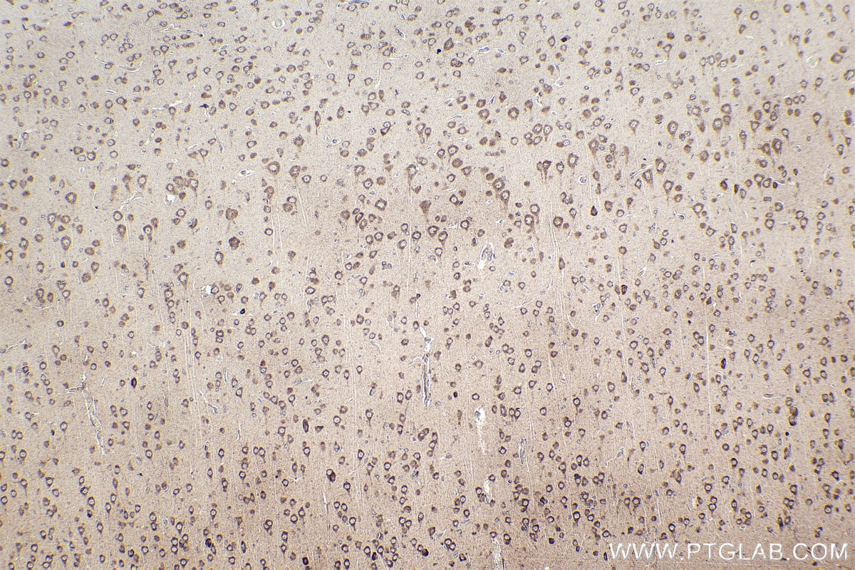 Immunohistochemistry (IHC) staining of rat brain tissue using RPL12 Polyclonal antibody (14536-1-AP)