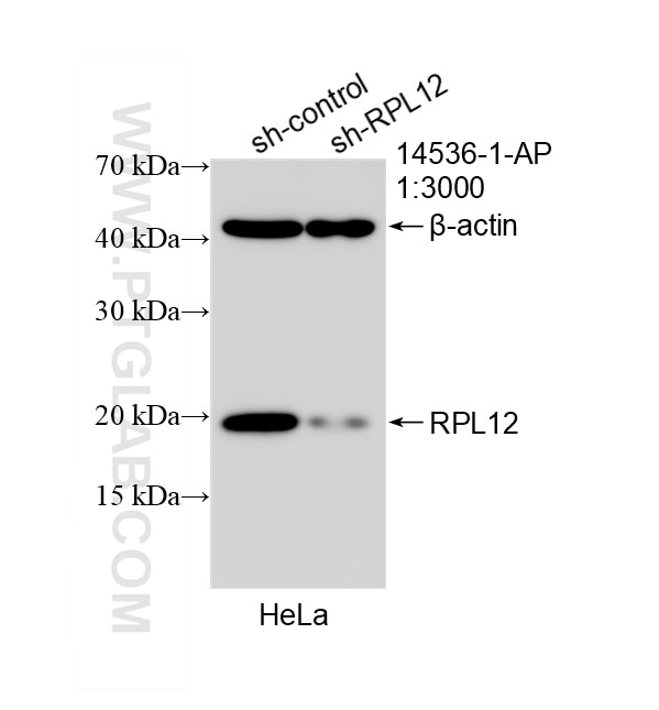 Western Blot (WB) analysis of HeLa cells using RPL12 Polyclonal antibody (14536-1-AP)