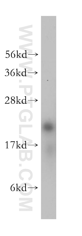 Western Blot (WB) analysis of Jurkat cells using RPL12 Polyclonal antibody (14536-1-AP)