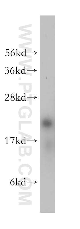 WB analysis of Jurkat using 14536-1-AP