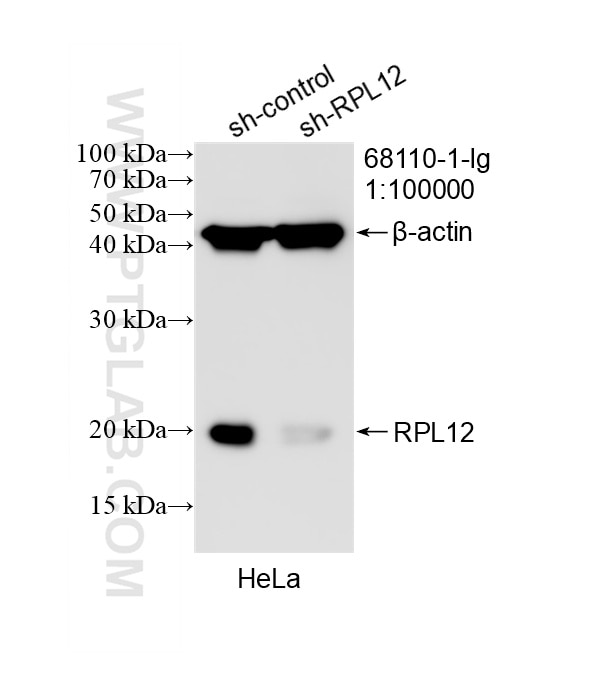 Western Blot (WB) analysis of HeLa cells using RPL12 Monoclonal antibody (68110-1-Ig)