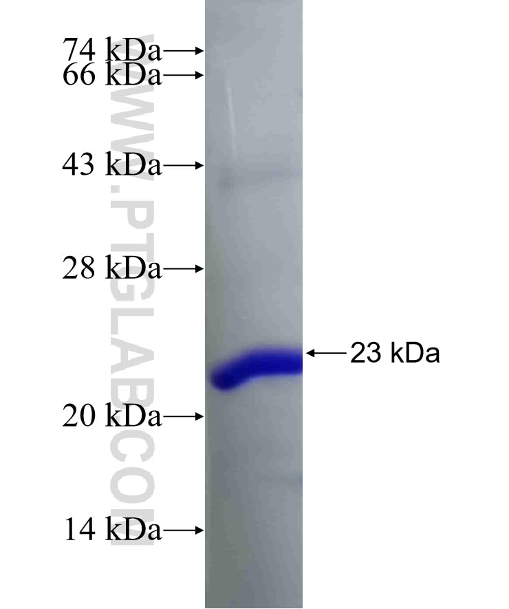 RPL12 fusion protein Ag6580 SDS-PAGE