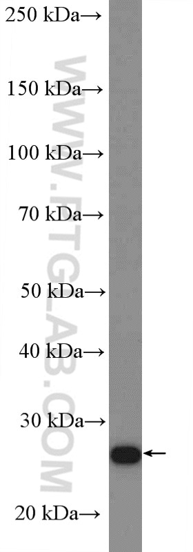 Western Blot (WB) analysis of SGC-7901 cells using RPL13 Polyclonal antibody (11271-1-AP)