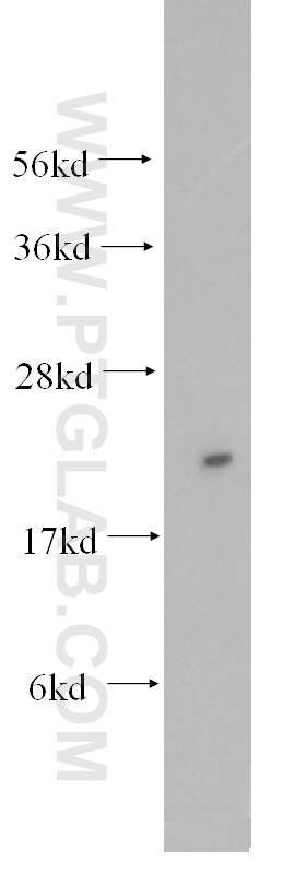 Western Blot (WB) analysis of human lung tissue using RPL13 Polyclonal antibody (11271-1-AP)