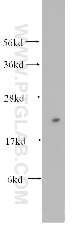 Western Blot (WB) analysis of human lung tissue using RPL13 Polyclonal antibody (11271-1-AP)