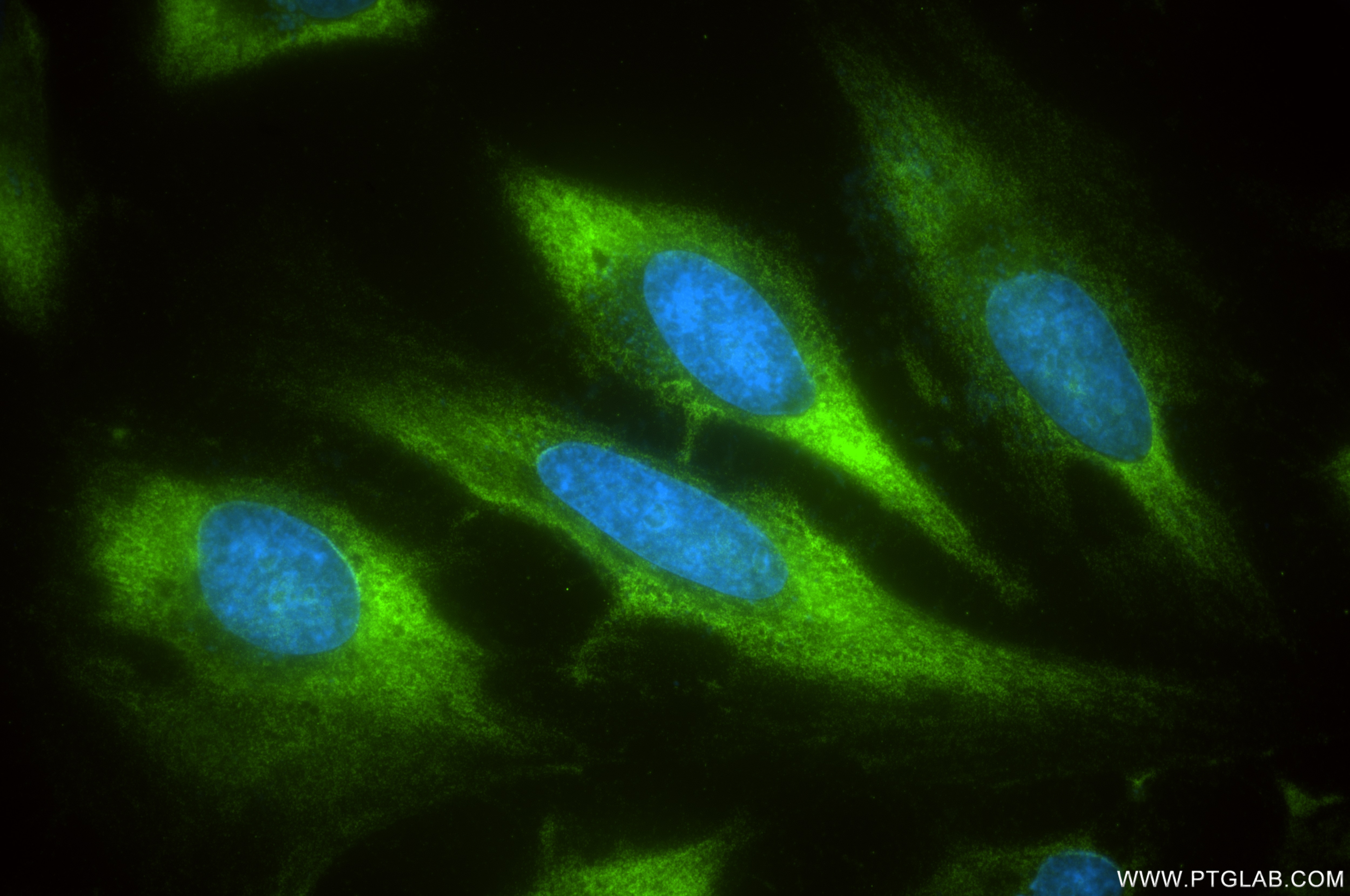 Immunofluorescence (IF) / fluorescent staining of HeLa cells using RPL13 Recombinant antibody (86205-2-RR)