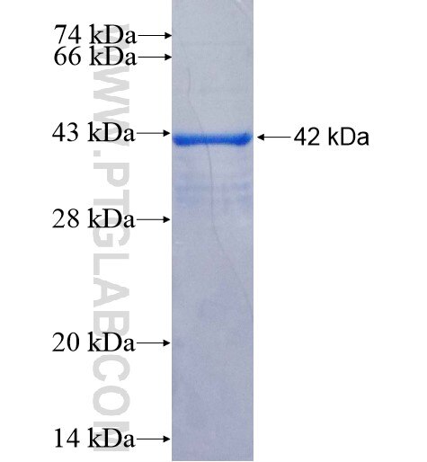 RPL13 fusion protein Ag1814 SDS-PAGE