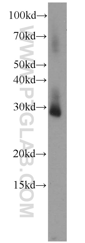 Western Blot (WB) analysis of A549 cells using RPL13A Polyclonal antibody (14633-1-AP)