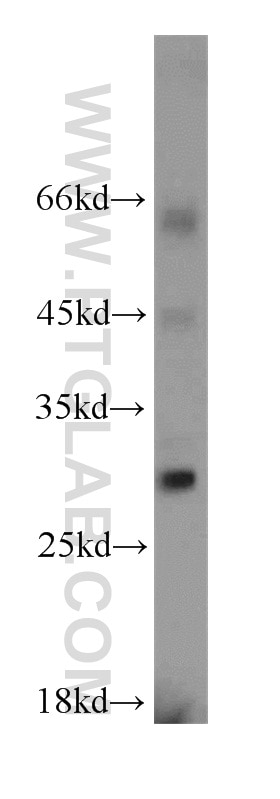 Western Blot (WB) analysis of Jurkat cells using RPL13A Polyclonal antibody (14633-1-AP)