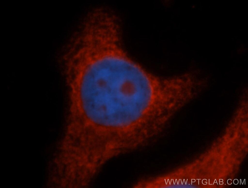 Immunofluorescence (IF) / fluorescent staining of HepG2 cells using RPL14 Polyclonal antibody (14991-1-AP)