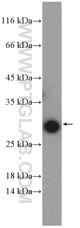 Western Blot (WB) analysis of mouse liver tissue using RPL14 Polyclonal antibody (14991-1-AP)