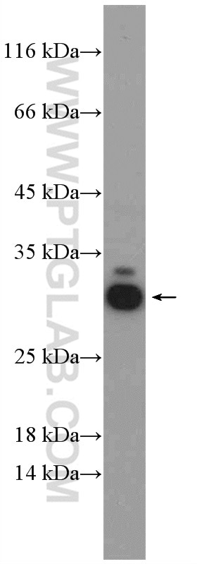 Western Blot (WB) analysis of rat liver tissue using RPL14 Polyclonal antibody (14991-1-AP)