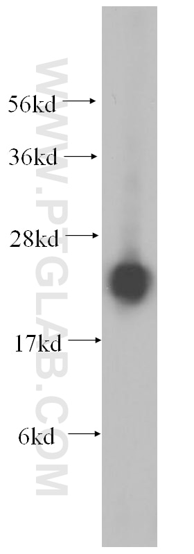 Western Blot (WB) analysis of HeLa cells using RPL14 Polyclonal antibody (14991-1-AP)
