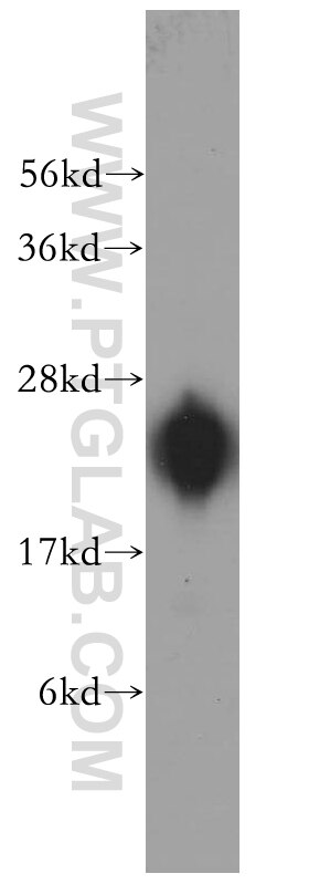 Western Blot (WB) analysis of MCF-7 cells using RPL14 Polyclonal antibody (14991-1-AP)