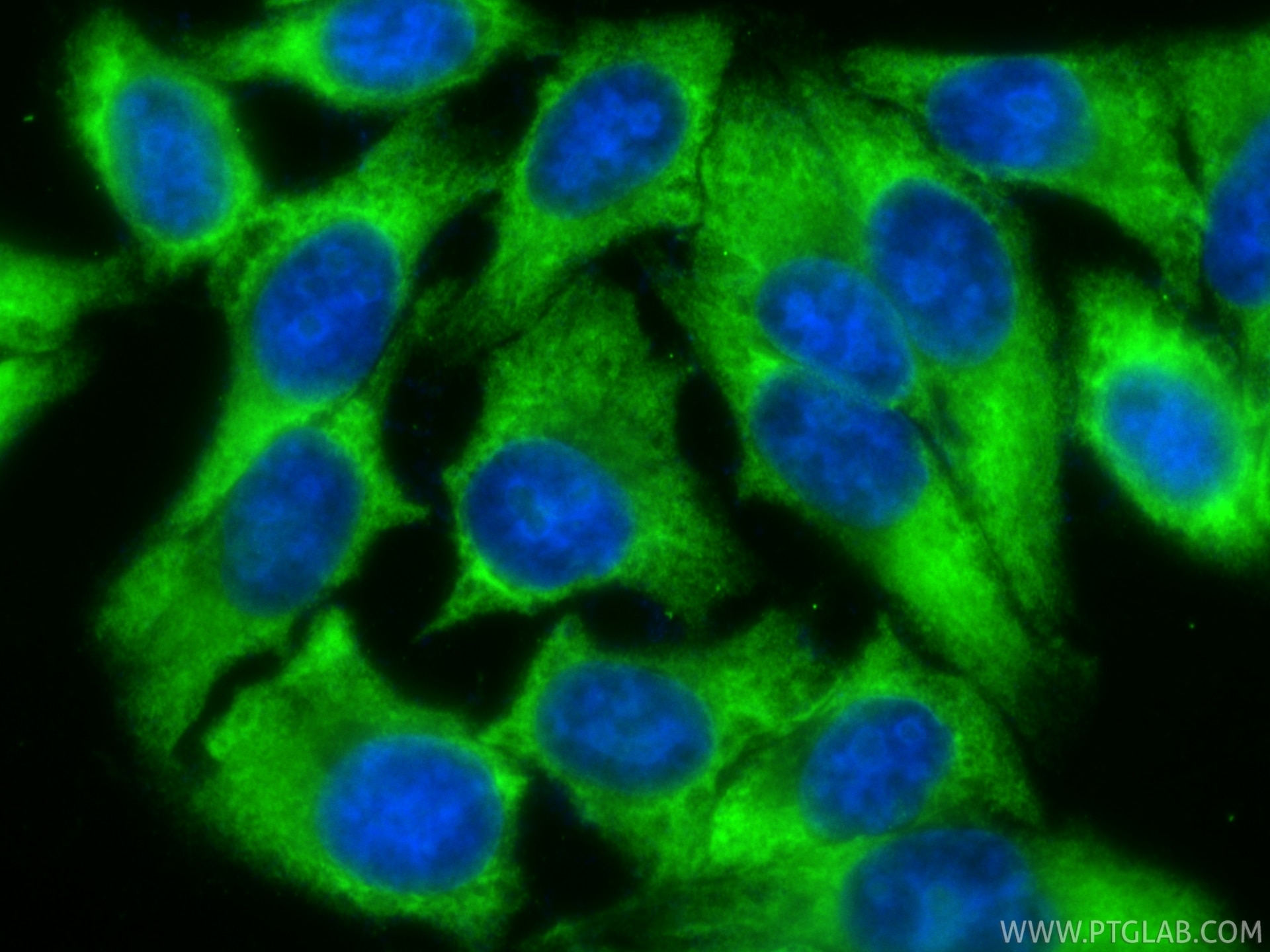 IF Staining of HepG2 using CL488-82688 Immunofluorescence (IF) / fluorescent staining of HepG2 cells using CoraLite® Plus 488-conjugated RPL14 Recombinant mo (CL488-82688)