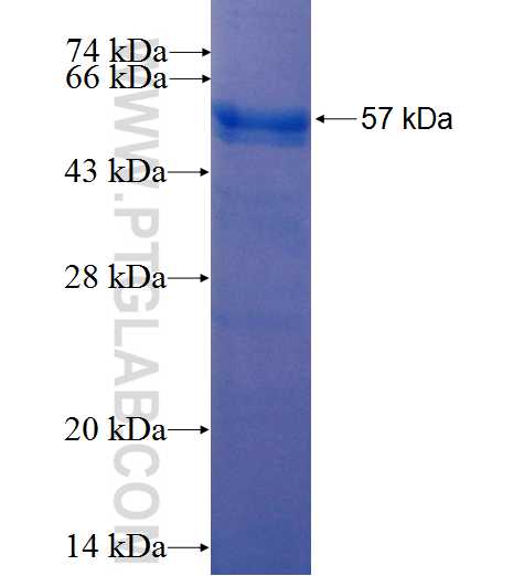 RPL14 fusion protein Ag6976 SDS-PAGE
