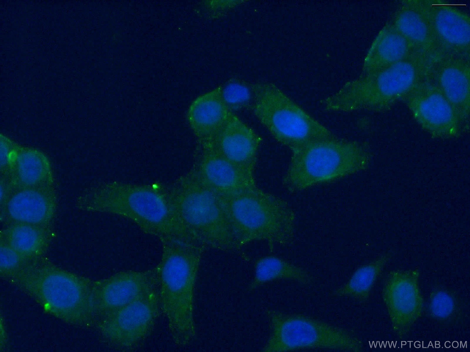 Immunofluorescence (IF) / fluorescent staining of HeLa cells using RPL15 Polyclonal antibody (16740-1-AP)