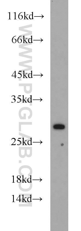 Western Blot (WB) analysis of K-562 cells using RPL15 Polyclonal antibody (16740-1-AP)