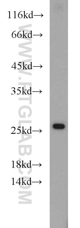 Western Blot (WB) analysis of HeLa cells using RPL15 Polyclonal antibody (16740-1-AP)
