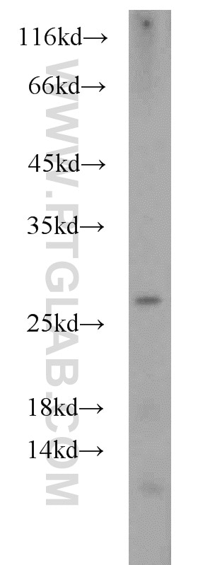Western Blot (WB) analysis of mouse brain tissue using RPL15 Polyclonal antibody (16740-1-AP)