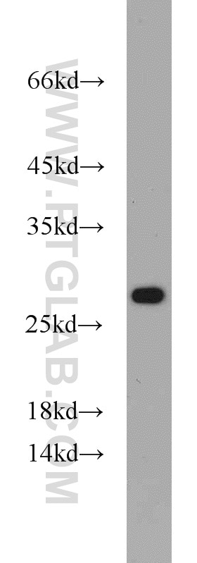 Western Blot (WB) analysis of SGC-7901 cells using RPL15 Polyclonal antibody (16740-1-AP)
