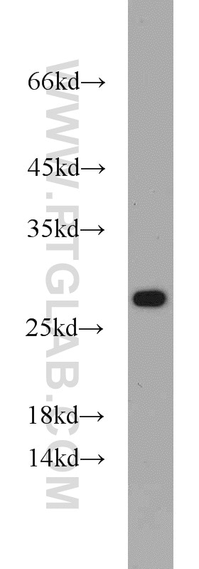 WB analysis of SGC-7901 using 16740-1-AP