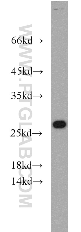Western Blot (WB) analysis of COLO 320 cells using RPL15 Polyclonal antibody (16740-1-AP)