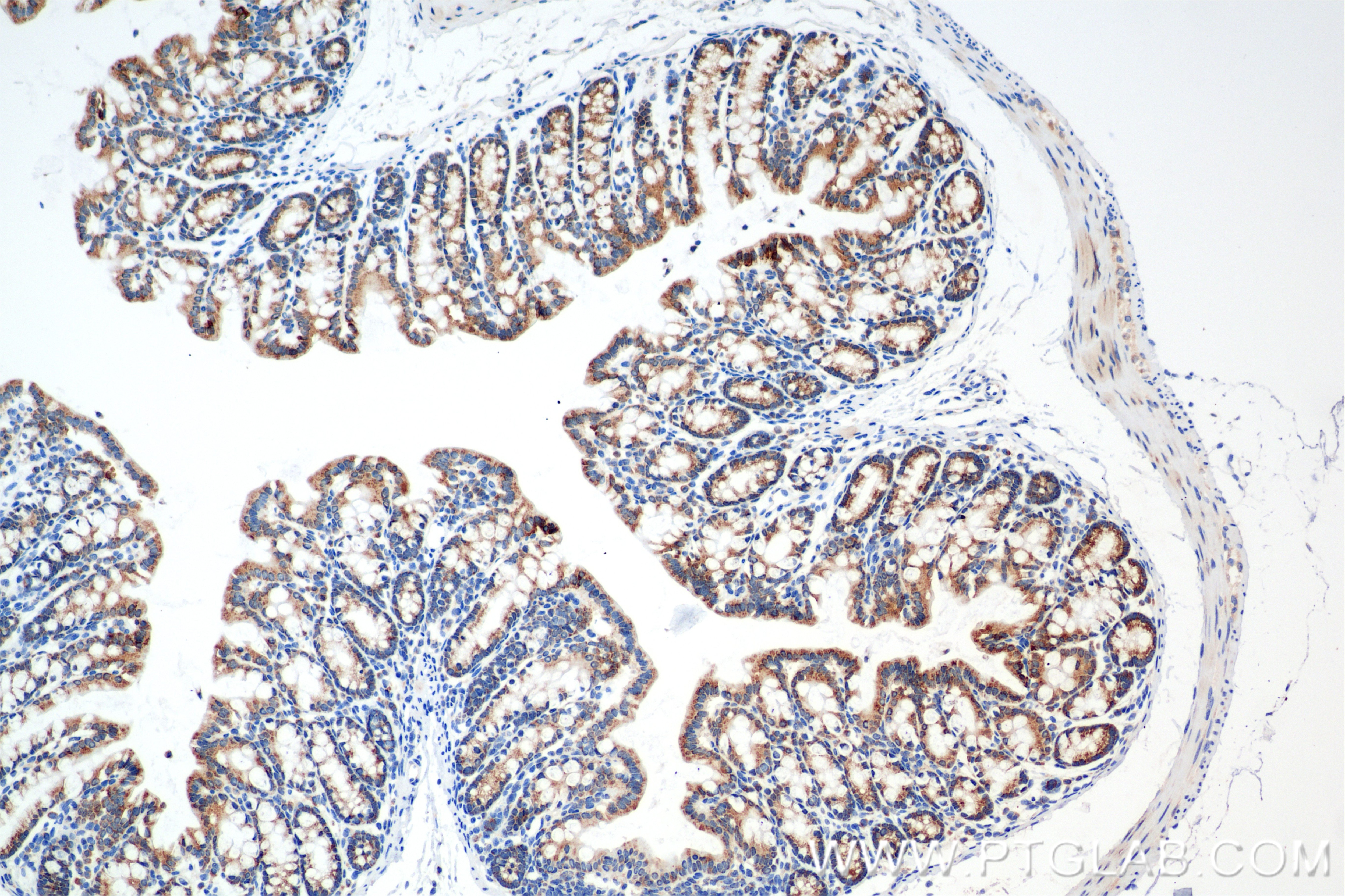 Immunohistochemistry (IHC) staining of mouse colon tissue using RPL15 Recombinant antibody (84900-1-RR)