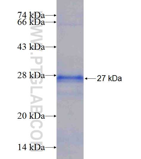 RPL15 fusion protein Ag9948 SDS-PAGE